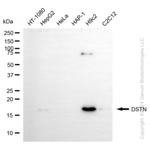KD-Validated DSTN Rabbit mAb (20 μl)