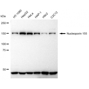 KD-ValidateNUP155 Rabbit mAb (20 μl)