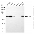 KD-Validated LGI1 Rabbit mAb (20 μl)