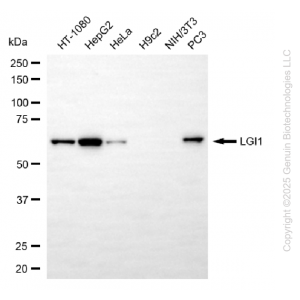 KD-Validated LGI1 Rabbit mAb (20 μl)