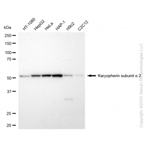 KD-Validated KPNA2 Rabbit mAb (20 μl)