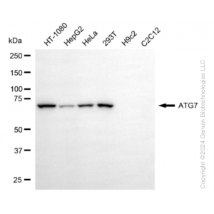KD-Validated ATG7 Rabbit mAb (20 μl)
