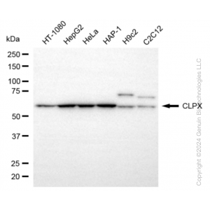 KD-Validated CLPX Rabbit mAb (20 μl)