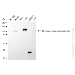 KD-Validated DPYD Rabbit mAb (20 μl)