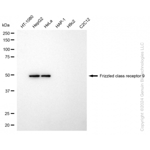 KD-Validated FZD9 Rabbit mAb (20 μl)