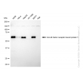 KD-Validated GRB7 Rabbit mAb (20 μl)