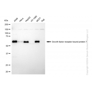 KD-Validated GRB7 Rabbit mAb (20 μl)