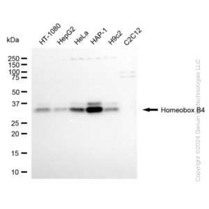 KD-Validated HOXB4 Rabbit mAb (20 μl)