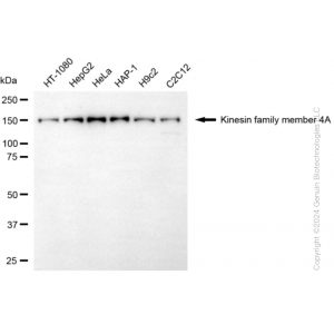 KD-Validated KIF4A Rabbit mAb (20 μl)