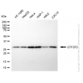 KD-Validated GTF2F2 Rabbit mAb (20 μl)