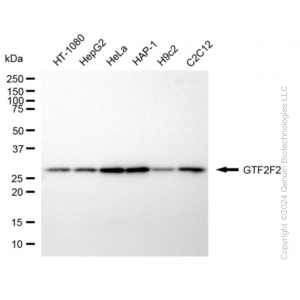 KD-Validated GTF2F2 Rabbit mAb (20 μl)