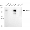 LifeSab™ KD-Validated MERTK Rabbit mAb (20 μl)