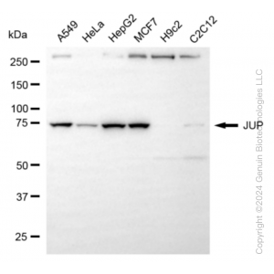 KD-Validated JUP Rabbit mAb (20 μl)