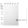 KD-Validated CRYAB Rabbit mAb (20 μl)