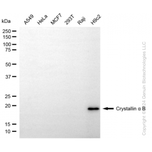KD-Validated CRYAB Rabbit mAb (20 μl)