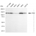 KD-Validated IFIH1 Rabbit mAb (20 μl)