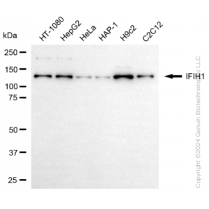 KD-Validated IFIH1 Rabbit mAb (20 μl)