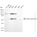 KD-Validated INHBB Rabbit mAb (20 μl)