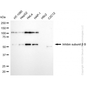 KD-Validated INHBB Rabbit mAb (20 μl)