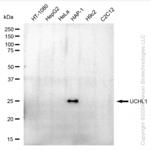 KD-Validated UCHL1 Rabbit mAb (20 μl)