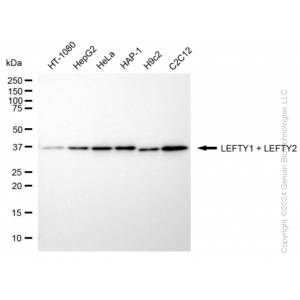 KD-Validated LEFTY1/LEFTY2 Rabbit mAb (20 μl)