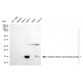 KD-Validated CRABP1 Rabbit mAb (20 μl)