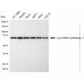 KD-Validated KARS1 Rabbit mAb (20 μl)