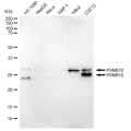 LifeSab™ KD-Validated PSMB10 Rabbit mAb (20 μl)