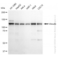 KD-Validated VCL Rabbit mAb (20 μl)