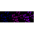 KD-Validated JAK1 Rabbit mAb (20 μl)