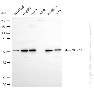 KD-Validated SOX10 Rabbit mAb (20 μl)