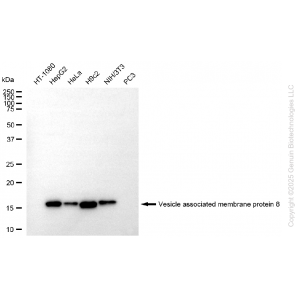 KD-Validated VAMP8 Rabbit mAb (20 μl)