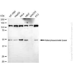 KD-Validated ADSL Mouse mAb (20 μl)