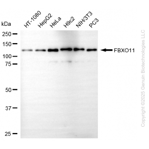 KD-Validated FBXO11 Mouse mAb (20 μl)