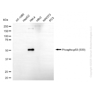 KD Validated Phospho-p53 (S33) Rabbit mAb (20 μl)