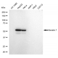 LifeSab™ KD-Validated K7 Rabbit mAb (20 μl)