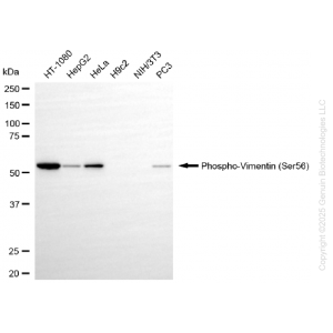 KD-Validated Phospho-VIM (Ser56) Rabbit mAb (20 μl)