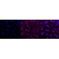 KD-Validated PPP3CA Rabbit mAb (20 μl)