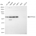 LifeSab™ KD-Validated PPP3CA Rabbit mAb (20 μl)