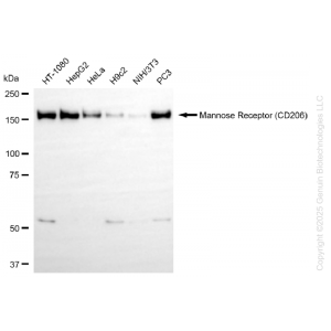 KD-Validated MRC1 (CD206) Rabbit mAb (20 μl)