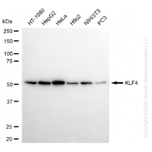 KD-Validated KLF4 Rabbit mAb (20 μl)