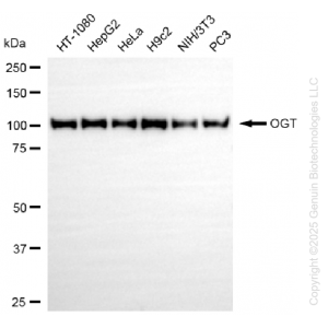 KD-Validated OGT Rabbit mAb (20 μl)