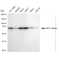 KD-Validated NF2 Rabbit mAb (20 μl)