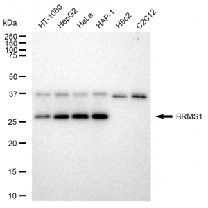 KD-Validated BRMS1 Rabbit mAb (20 μl)
