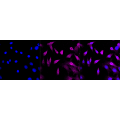 KD-Validated AR Rabbit mAb (20 μl)