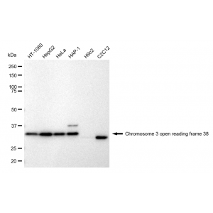 KD-Validated C3orf38 Rabbit mAb (20 μl)
