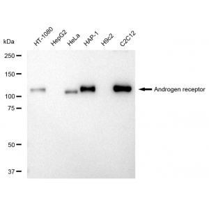 KD-Validated AR Rabbit mAb (20 μl)