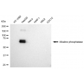 KD-Validated ALPI Rabbit mAb (20 μl)