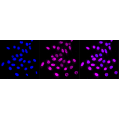 KD-Validated CSNK2B Rabbit mAb (20 μl)