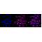 KD-Validated CSNK2B Rabbit mAb (20 μl)